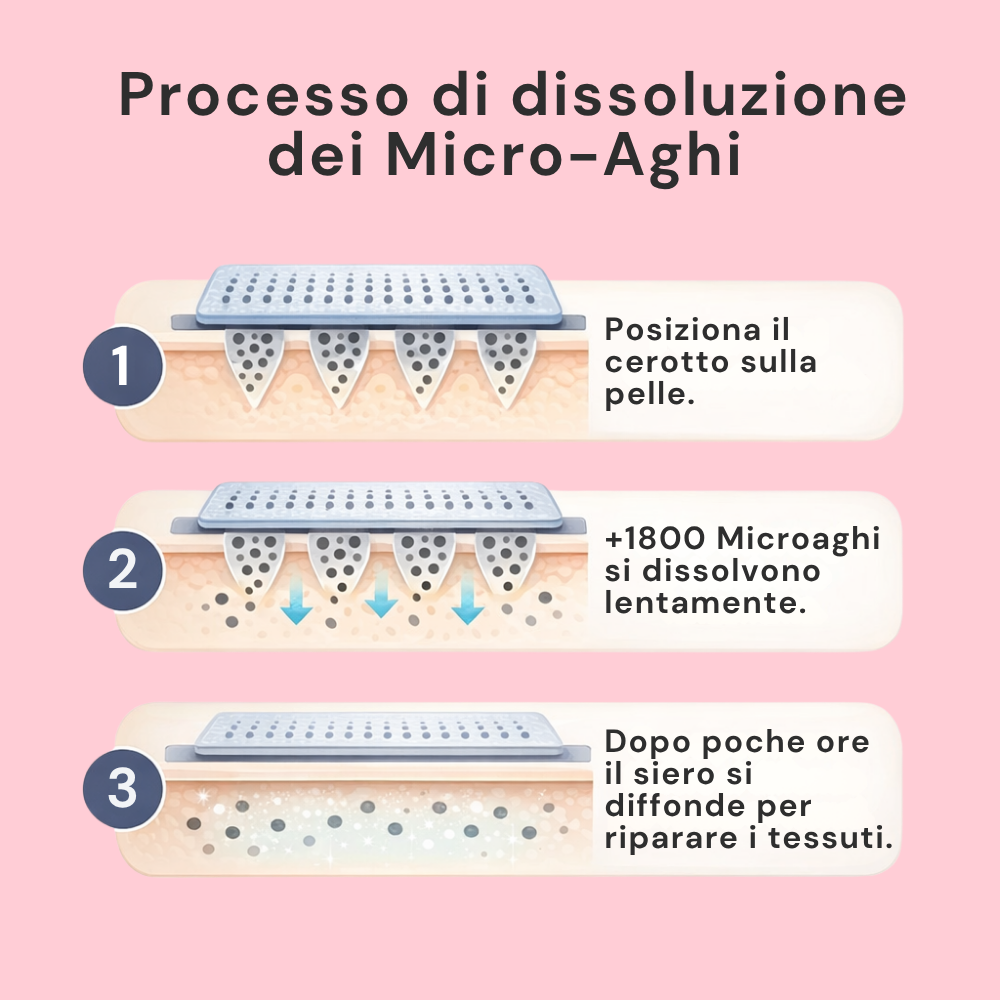 Sereina® MicroDerma  —  Sistema di Micronfusione