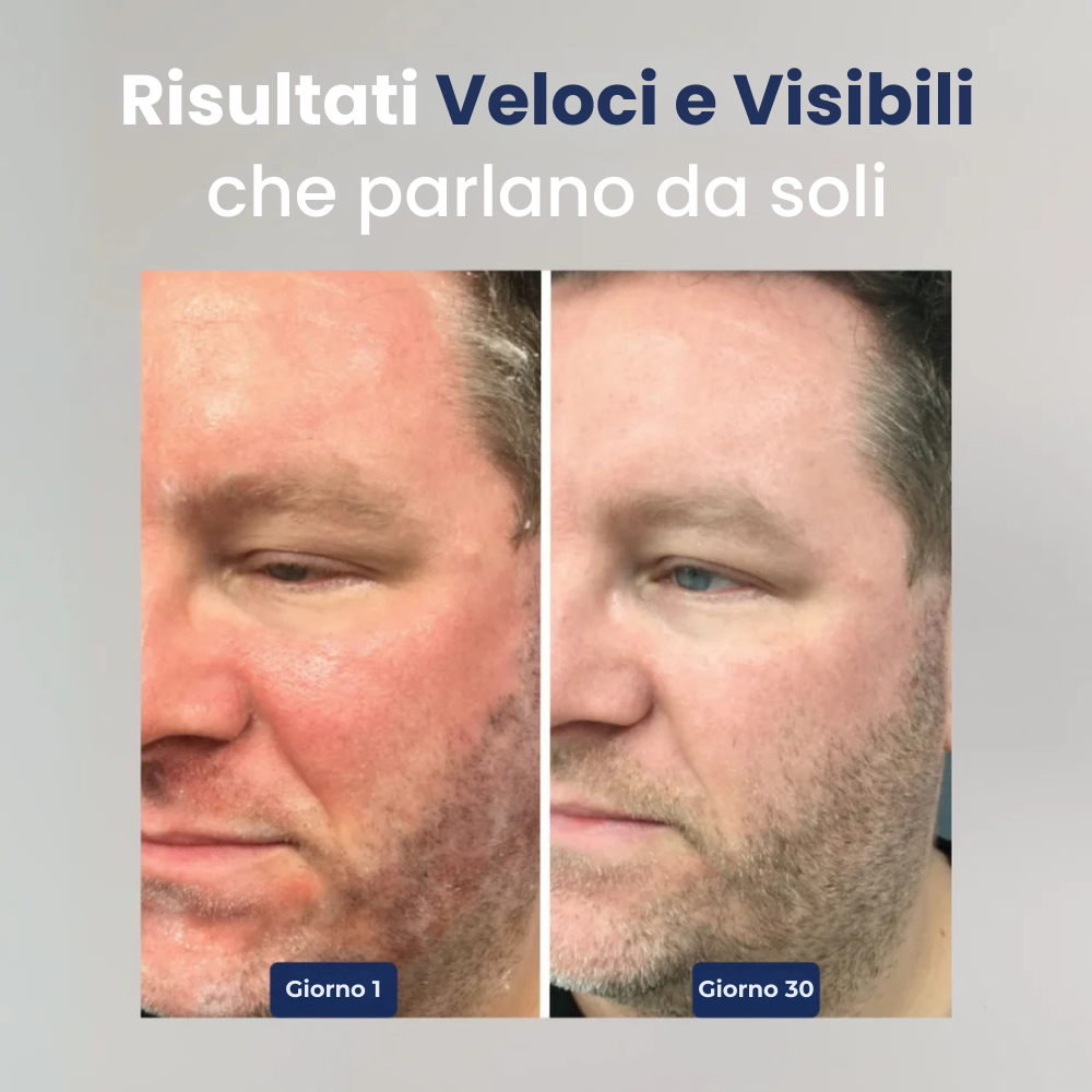 Sereina® - Sistema Dermatologico Avanzato per il Ripristino della Pelle