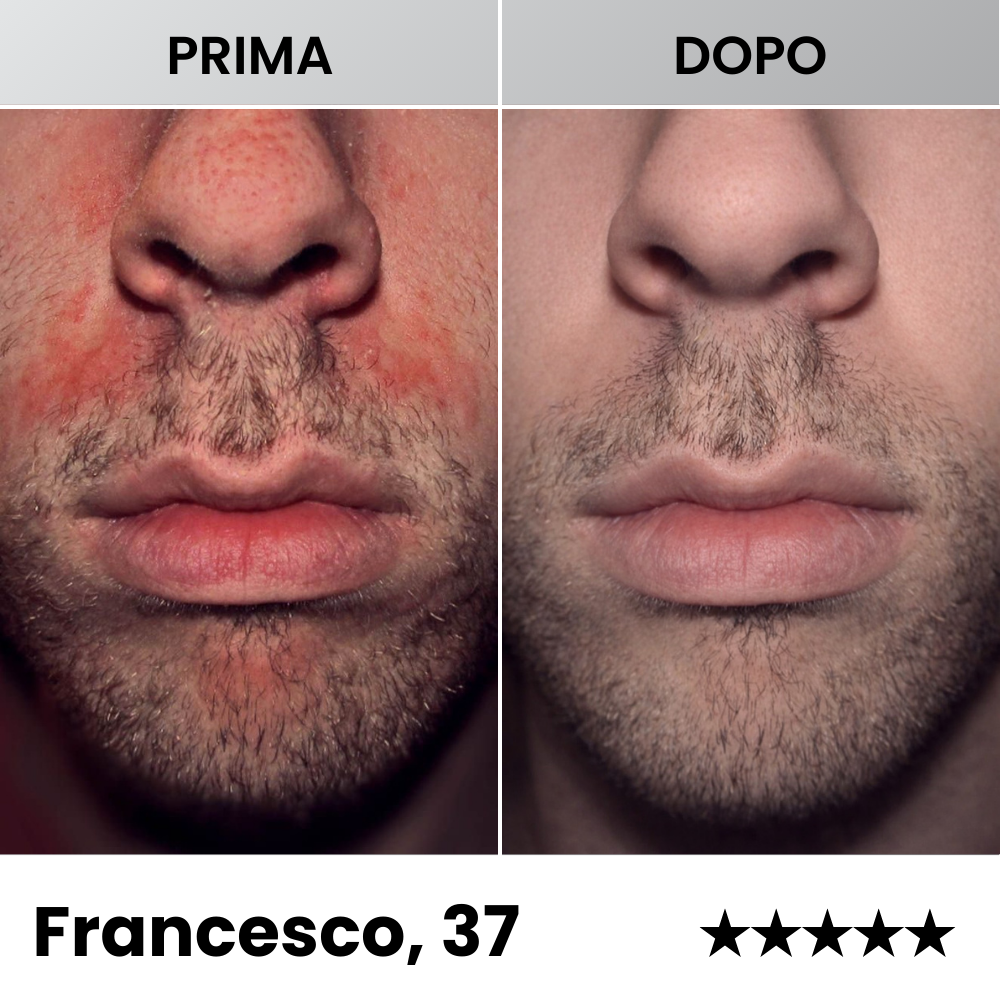 Sereina® - Balsamo Dermatologico Avanzato per il Ripristino della Pelle