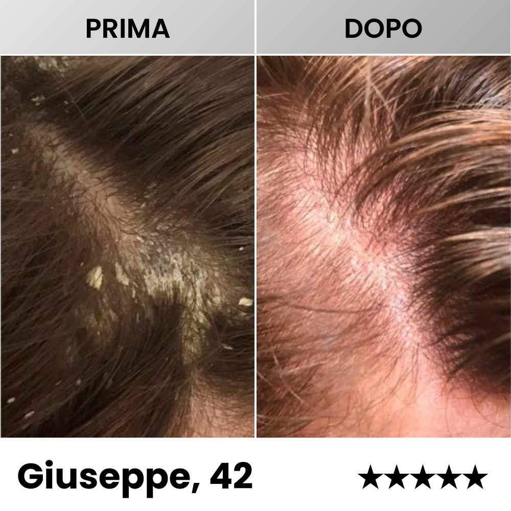 Sereina® - Balsamo Dermatologico Avanzato per il Ripristino della Pelle
