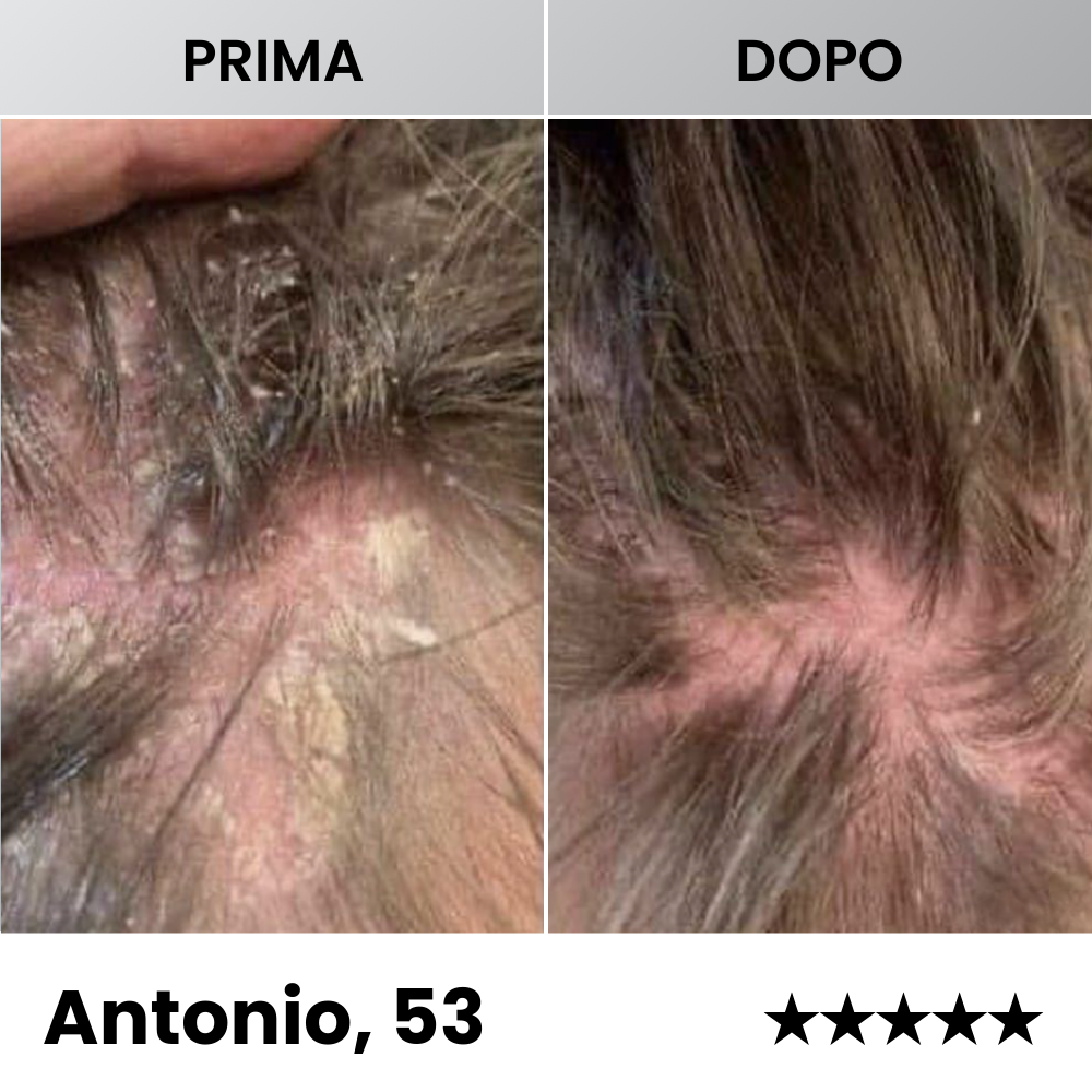 Sereina® - Balsamo Dermatologico Avanzato per il Ripristino della Pelle