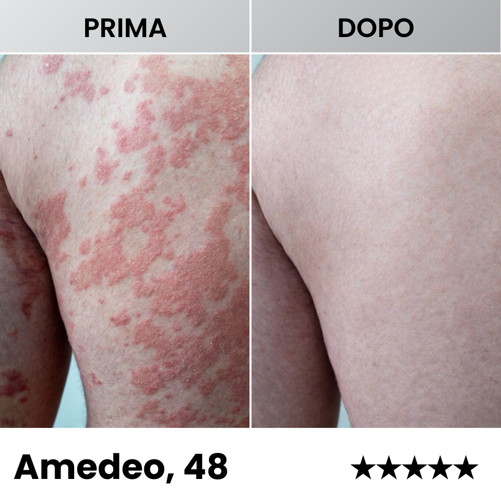 Sereina® - Balsamo Dermatologico Avanzato per il Ripristino della Pelle